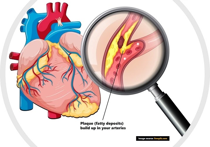 Coronary heart disease Coronary artery disease in Hindi