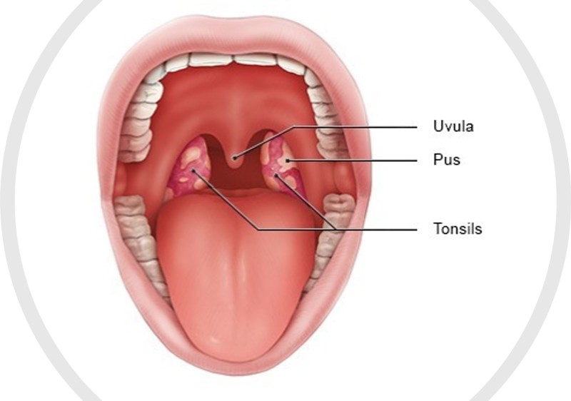 Tonsils meaning in Hindi