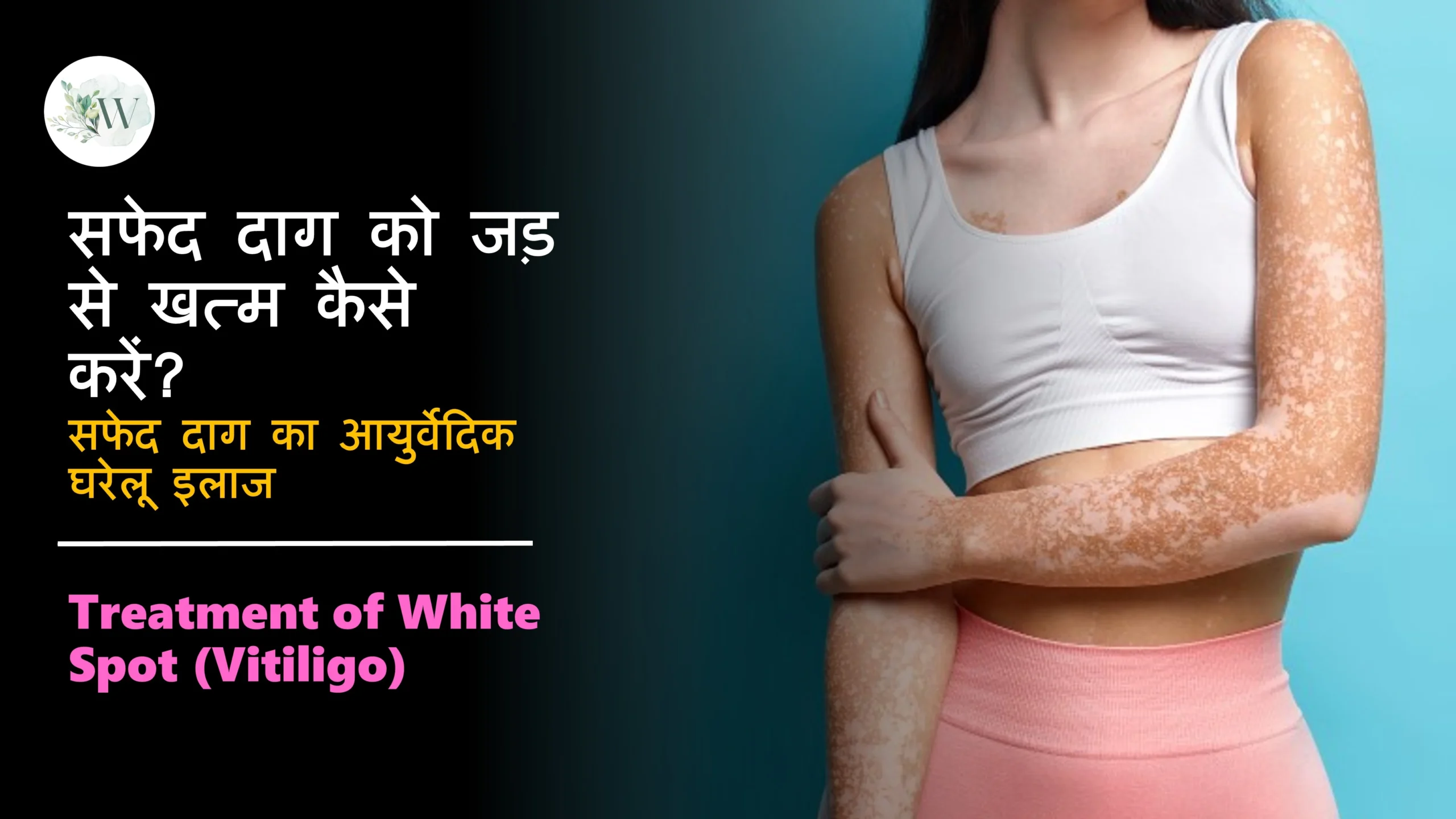 How to Treat White Spot in Hindi